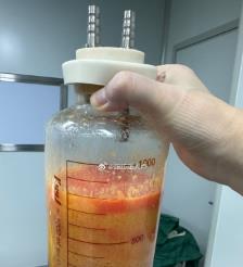东方水动力吸脂手术要做多久？